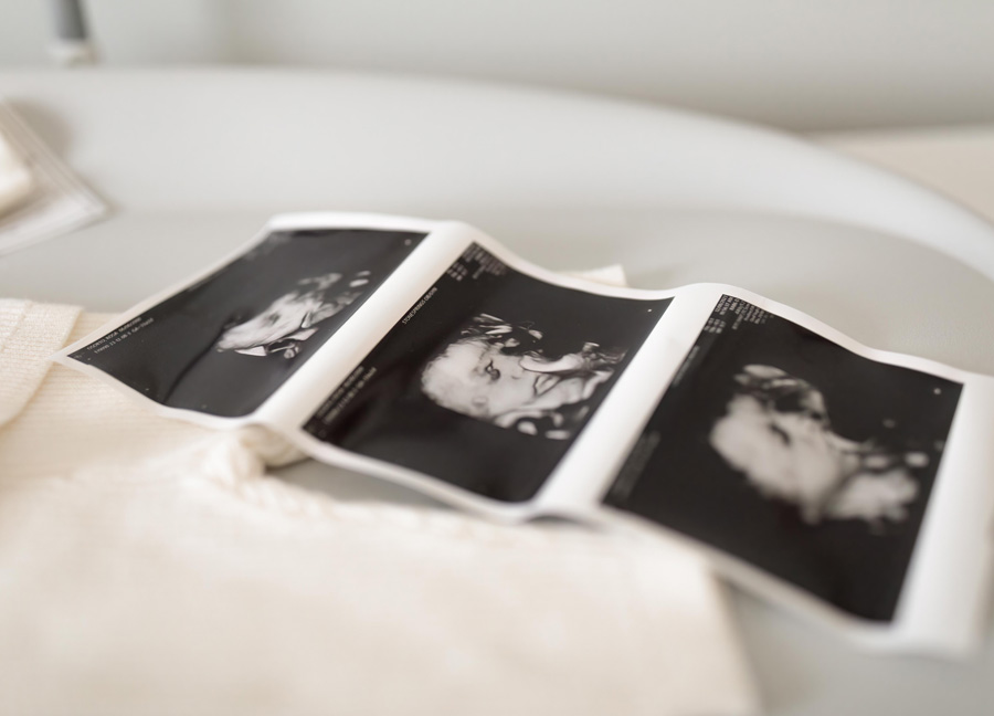 ultrasound photos captured by a newborn photographer in Washington D.C.